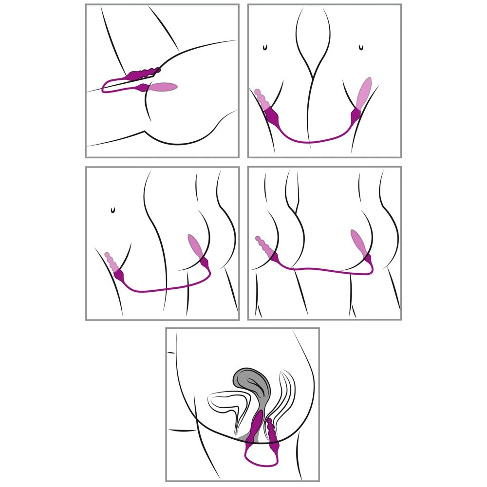 Adrien Lastic Remote Controlled 2X Double Ended Vibrator|Kit View|"Complete pleasure system - kit view"