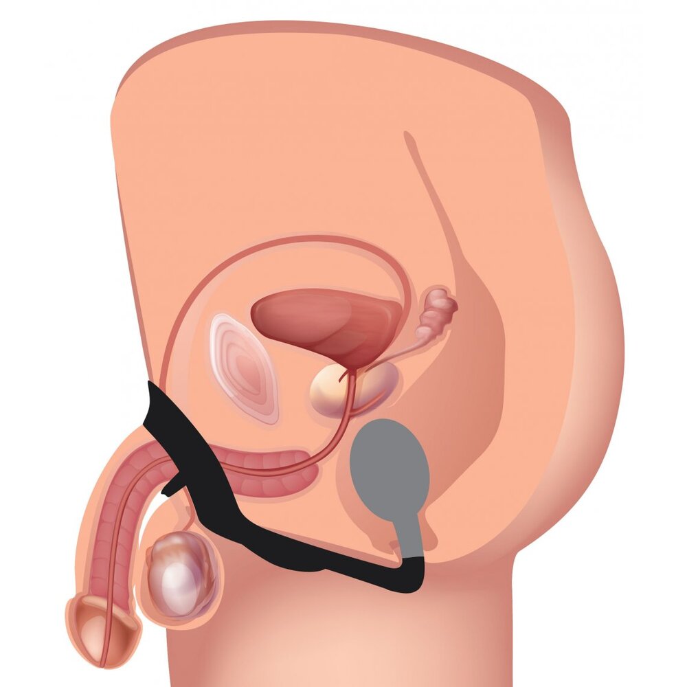 XR-Alpha-Pro-10X-P-Bomb-Cock-and-Ball-Ring-With-Anal-Plug|Detail View|"product features-detail view"